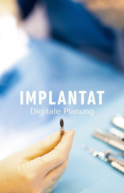 Digitale Planung ist kein „Nice-to-have“ mehr – sie ist der Gamechanger in der Implantologie.Statt „Pi mal Daumen“ wird heute millimetergenau geplant:
👉 Die Position des Implantats wird bereits vor dem Eingriff exakt festgelegt.
👉 Das Ergebnis? Eine Krone, die nicht nur passt – sondern langfristig funktioniert und ästhetisch überzeugt.Für dich als Patient bedeutet das:
✨ mehr Sicherheit
✨ bessere Ergebnisse
✨ langfristige ZufriedenheitDenn am Ende zählt nur eins:
👉 Dass du Jahre später noch genauso gerne lächelst wie am ersten Tag.💬 Wusstest du, dass moderne Implantatplanung komplett digital möglich ist?#dentalexcellence #meiningen #Implantologie #DigitaleZahnmedizin #Zahnarztpraxis